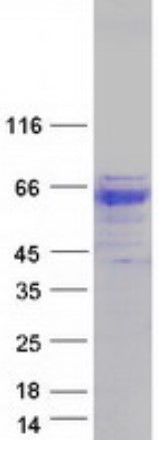 SDS PAGE (GBA-5174H).jpg